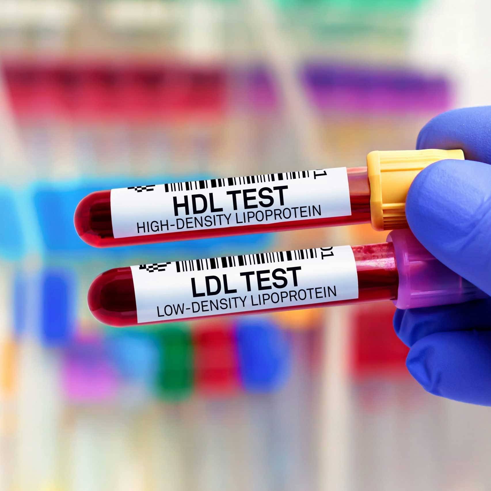 Metabolic Syndrome - Signs of Inflammation