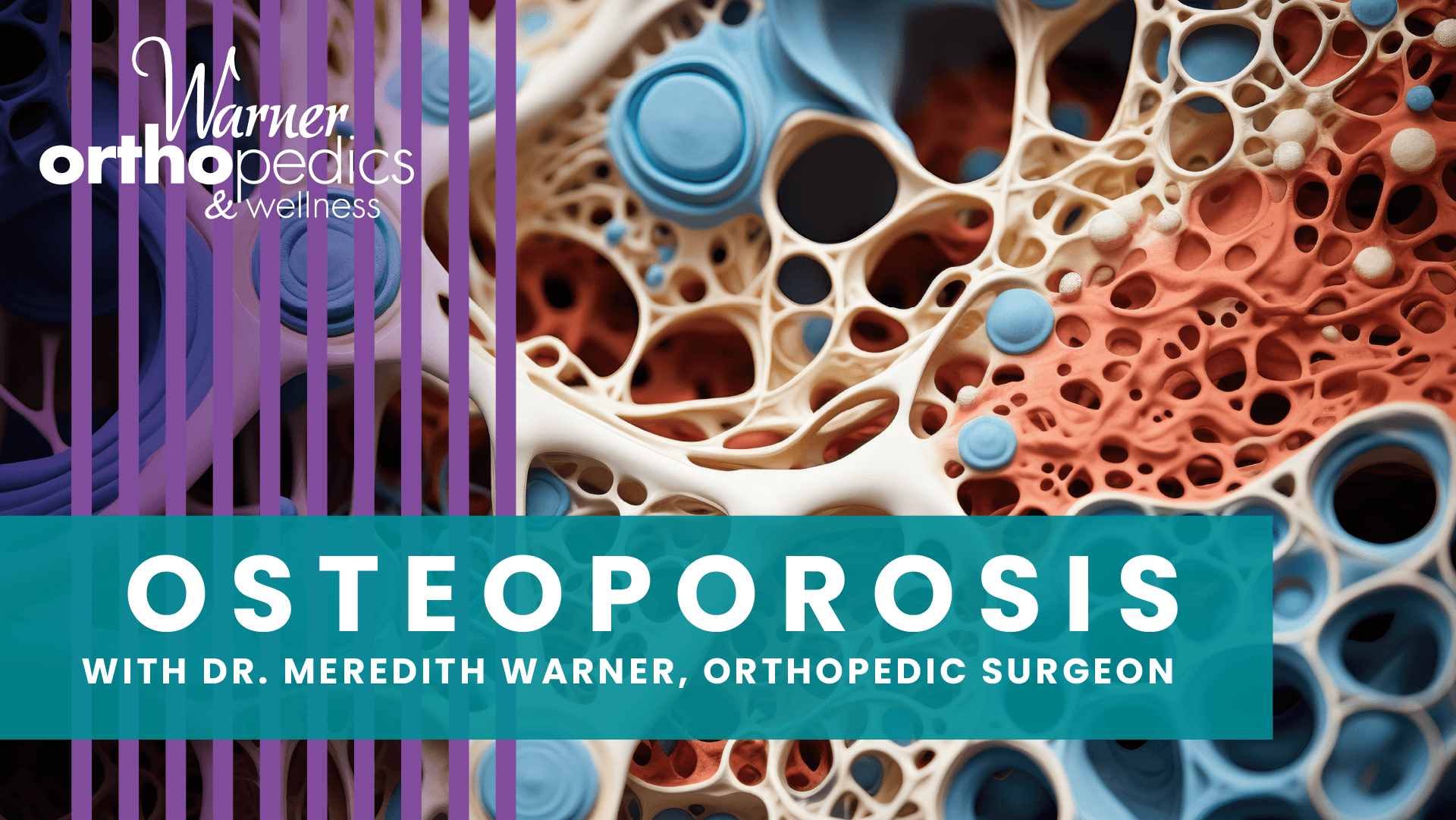 Close-up of porous bone showing osteoporosis info and Dr. Meredith Warner's supplements at Warner Orthopedics.