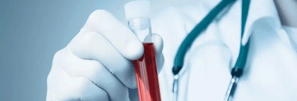 A person in a white coat and gloves holds a blood sample tube, with a stethoscope and supplements on the table.
