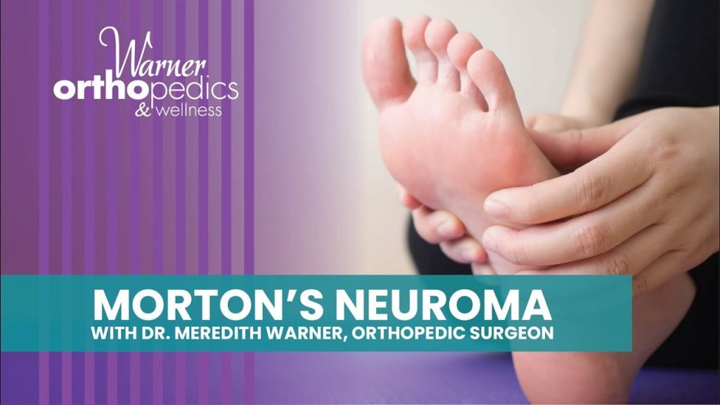 Morton's Neuroma